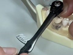 臼歯･隣在歯箇所に効果