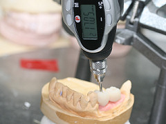 技工のエビデンスデータとなるロングスパンブリッジのスクリューに。